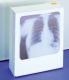 R�ntgenfilmbetrachter, 420 x 480 mm Betrachtungsfl�che
